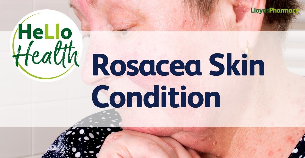 Rosacea Skin Condition