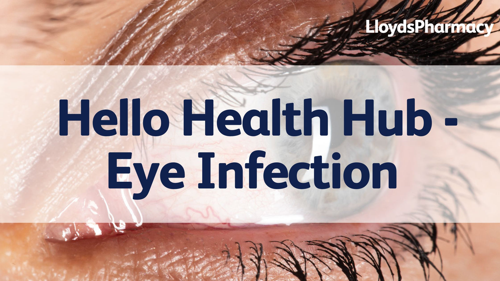 Eye Infections – Hello Health Hub